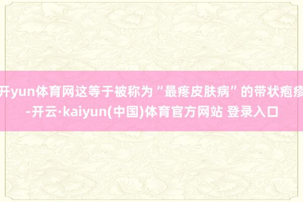开yun体育网这等于被称为“最疼皮肤病”的带状疱疹-开云·kaiyun(中国)体育官方网站 登录入口
